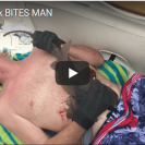 man gets bitten by shark